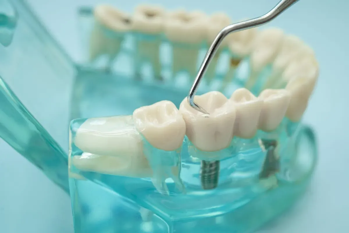 Restorative Dentistry: Rebuilding Your Smile's Health