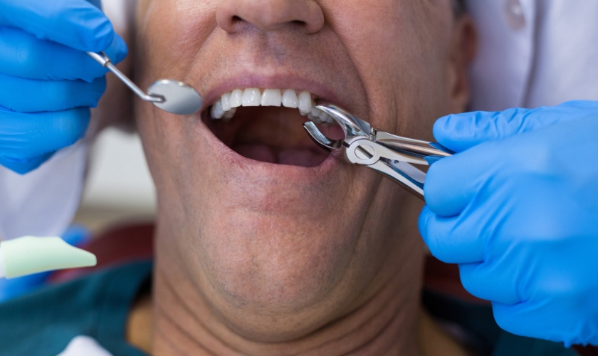 After Tooth Extraction guide