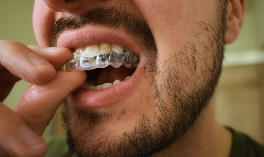 Can I Eat Normally with Invisalign