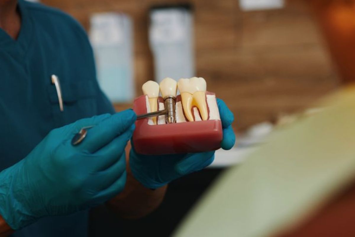 Can Smokers Get Dental Implants Successfully?