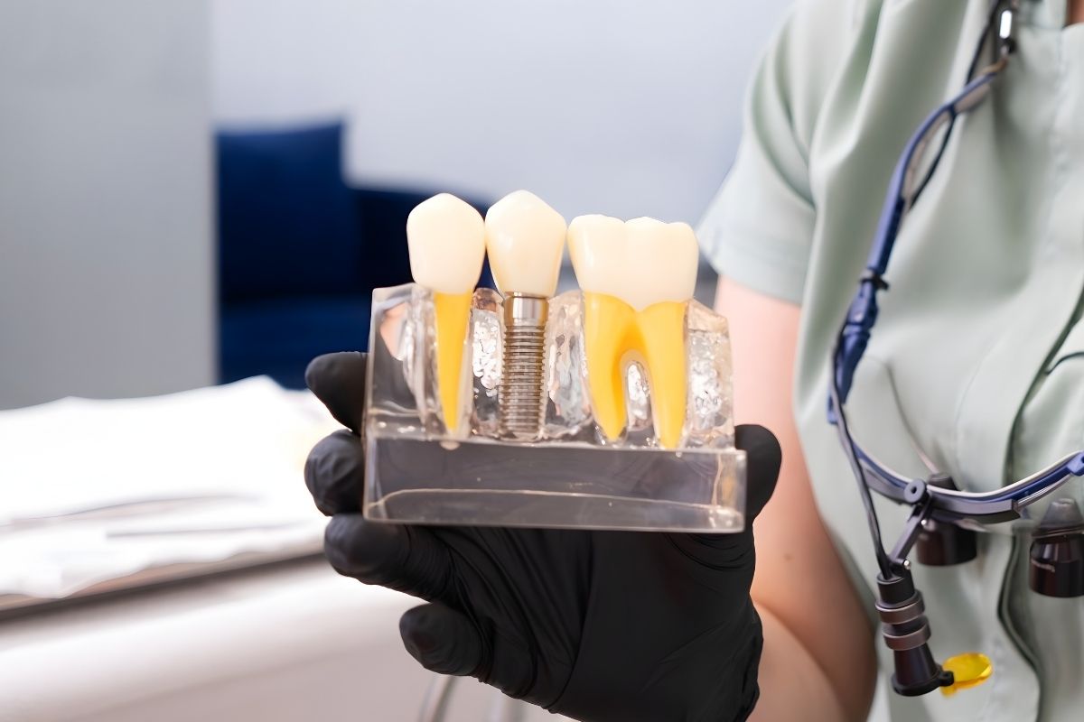 How Durable Are Dental Implants Compared to Natural Teeth?
